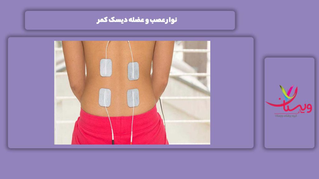 نوار عصب و عضله دیسک کمر نوار عصب و عضله دیسک کمر