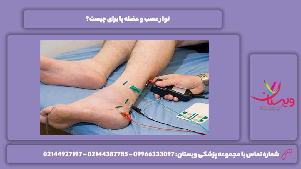 استفاده اصلی نوار عصب و عضله پا کاربرد نوار عصب و عضله