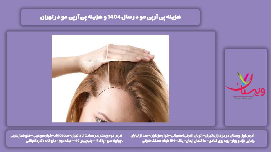 هزینه پی آر پی مو