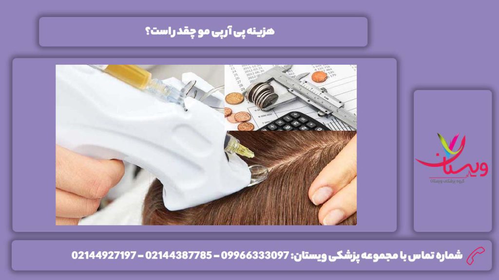 قیمت پی آرپی هزینه پی آر پی مو