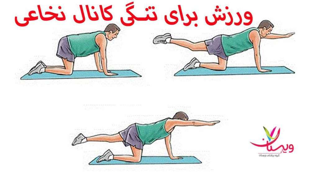ورزش برای تنگی کانال نخاعی ورزش برای تنگی کانال نخاع