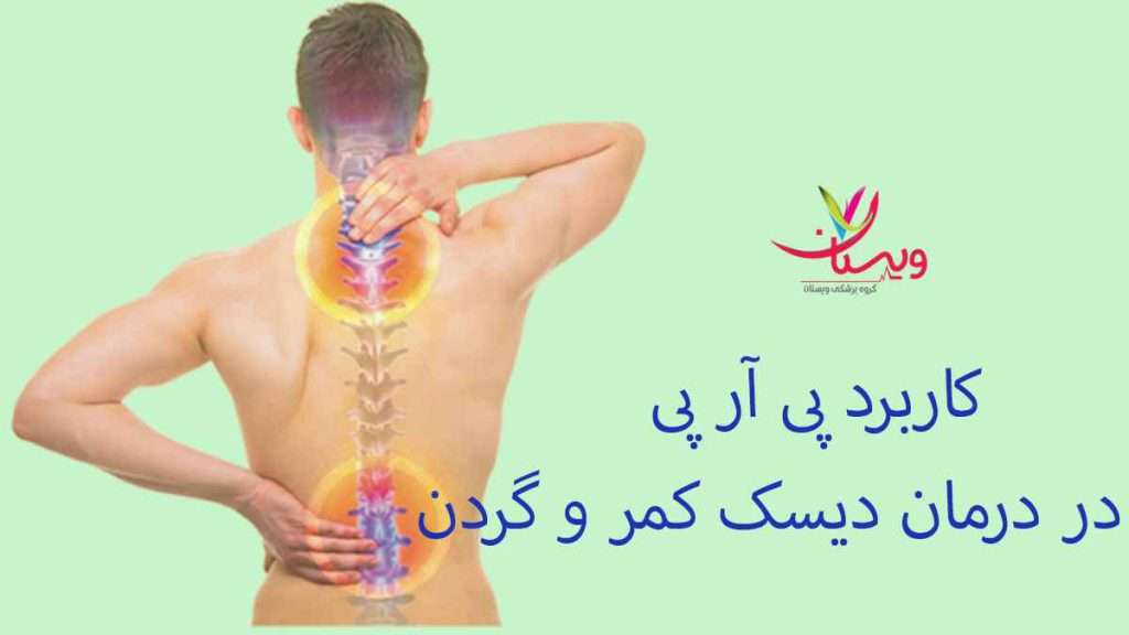 کاربرد پی آر پی کاربرد پی آر پی