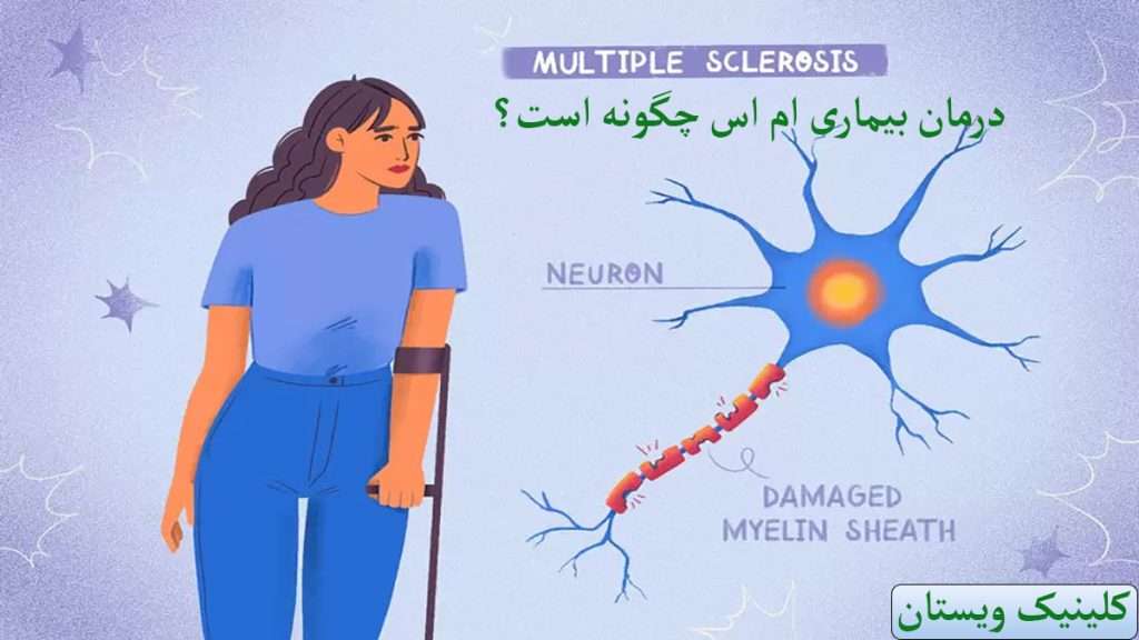 بیماری ام اس یک خانم دارای بیماری ام اس