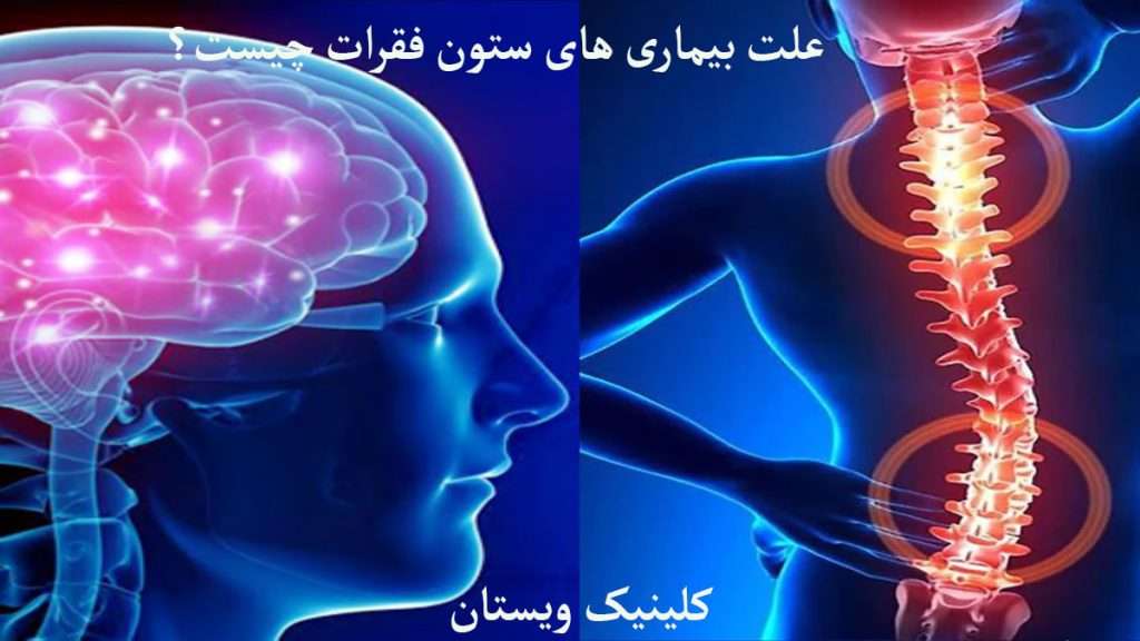 علت درد و مشکلات ستون فقرات درد در نواحی مغز و ستون فقرات را نشان می دهد