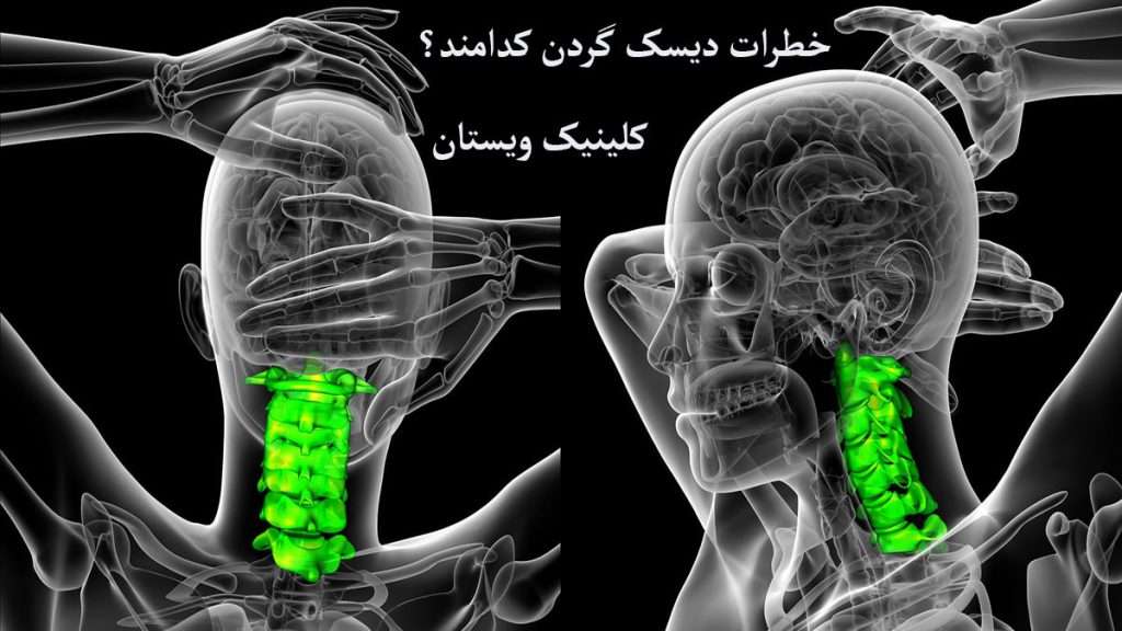 ستون فقرات ،جمجمه و درد در ناحیه گردن نشان داده می شود