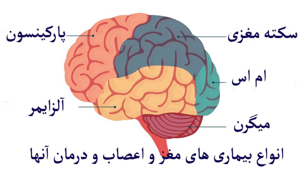 انواع بیماری های مغز و اعصاب و درمان آنها نام برده شده است