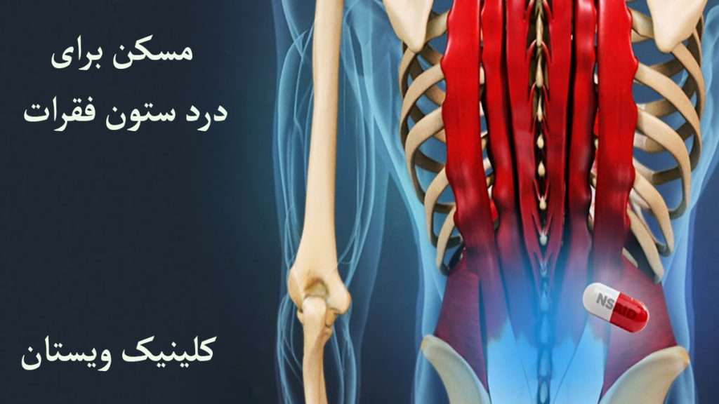 مسکن برای درد ستون فقرات درد در ناحیه ستون فقرات و قرص مسکن
