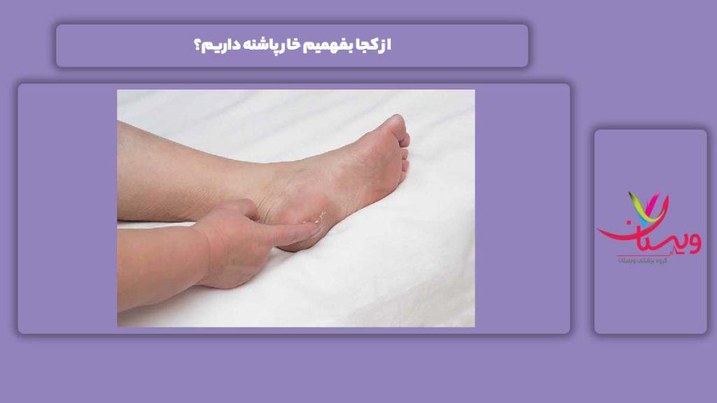 فهمیدن داشتن خار پاشنه از کجا بفهمیم خار پاشنه داریم؟