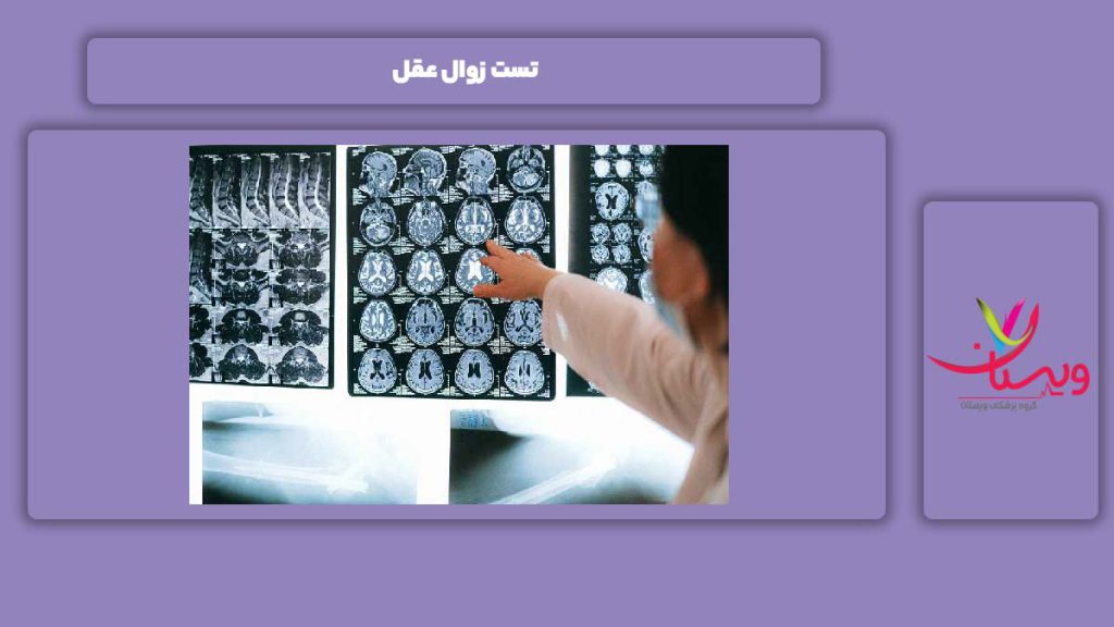 آزمایش دادن برای این مریضی تست زوال عقل