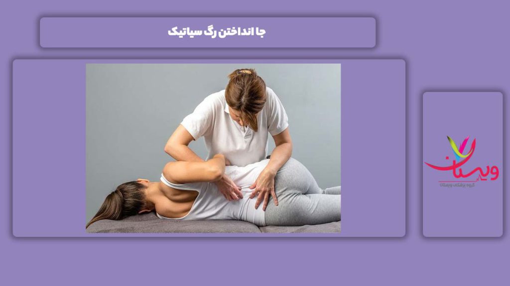 جا انداختن این رگ جا انداختن رگ سیاتیک