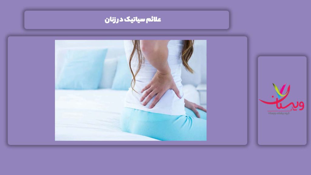 علامت این مریضی در خانمها علائم سیاتیک در زنان