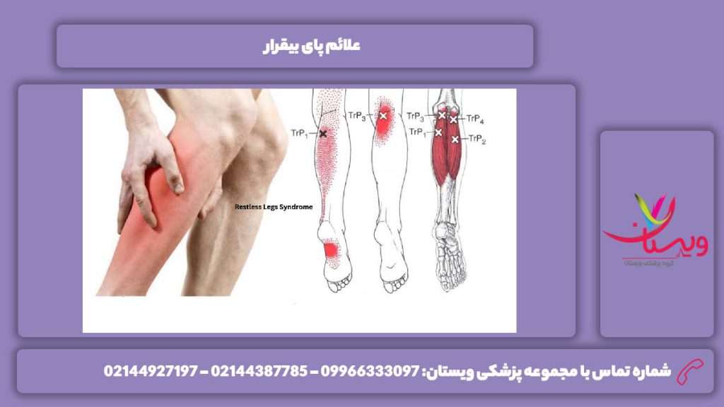 علائم پای بیقرار سندروم پای بیقرار