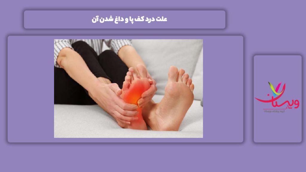 دلیلهای متداول این بیماری علت درد کف پا و داغ شدن آن