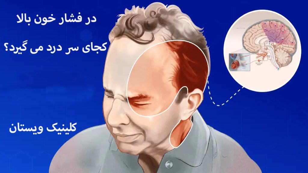 فشار خون بالا و سردرد یک آقا که سردرد دارد و تصویری از مغز او در بالای سرش نشان داده می شود