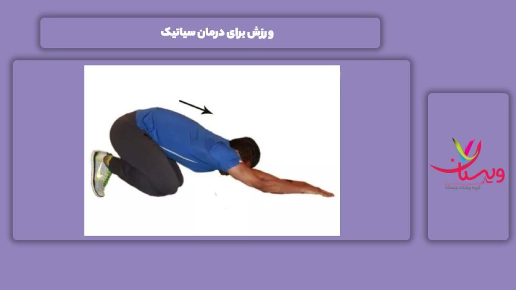 خوب بودن ورزش برای این بیماری ورزش برای درمان سیاتیک
