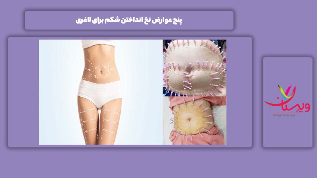 معایب نخ انداختن شکم برای لاغری 5 عوارض نخ انداختن شکم برای لاغری