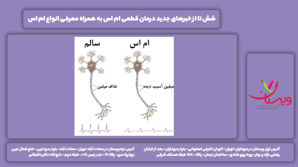 درمان قطعی MS