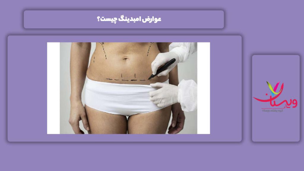 ضررهای انجام امبدینگ با امبدینگ چند کیلو لاغر می شویم