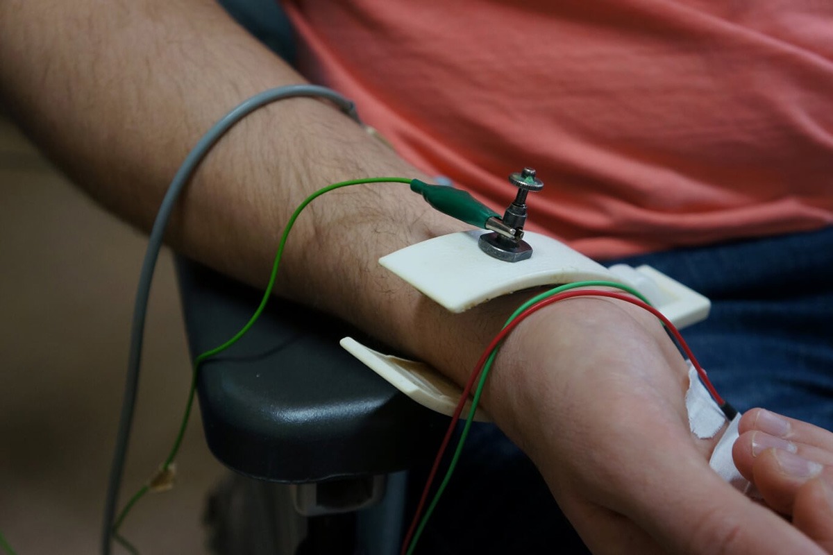 تست emg با بیمه آسماری نوار عصب عضله بیمه آسماری