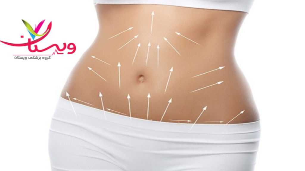 استفاده از امبدینگ برای لاغری امبدینگ لاغری شکم و پلو برای یک خانم