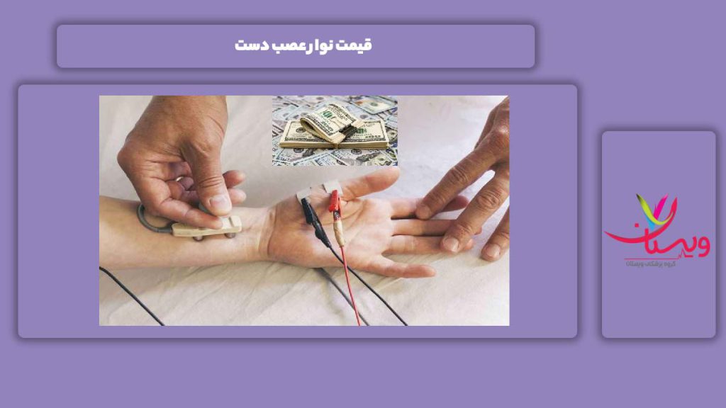 هزینه این آزمایش برای دست قیمت نوار عصب دست