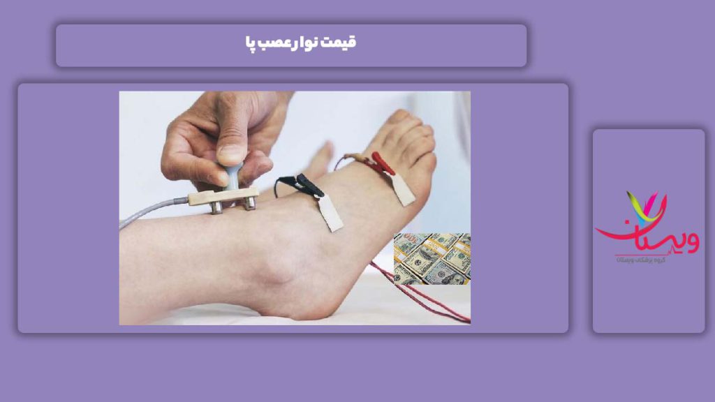 هزینه نوار عصب پا قیمت نوار عصب پا