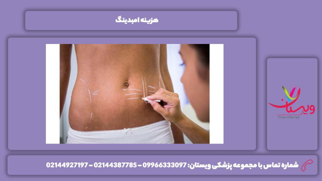 تعرفه امبدینگ با امبدینگ چند کیلو لاغر می شویم