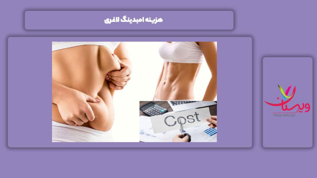 قیمت امبدینگ برای لاغری هزینه امبدینگ لاغری