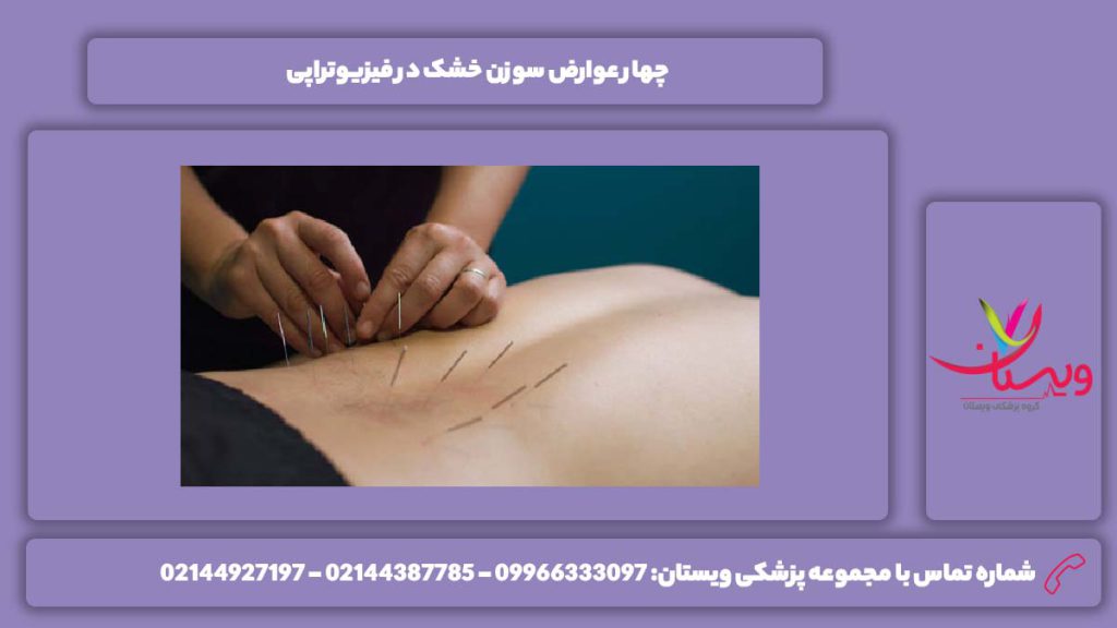 معایب انجام سوزن خشک در فیزیوتراپی سوزن خشک