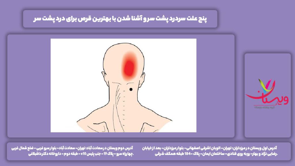 سردرد پشت سر