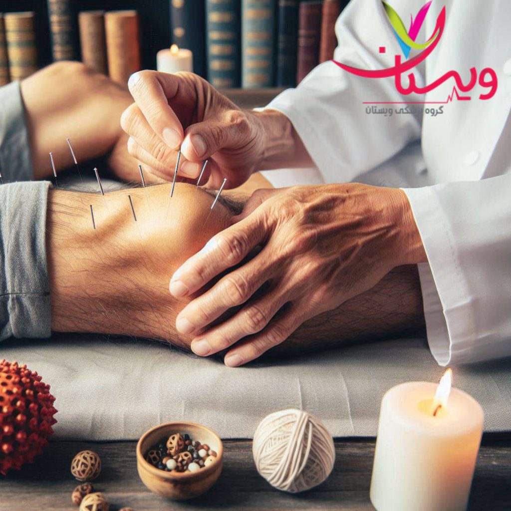طب سوزنی برای درمان آرتروز پزشک برای درمان آرتروز طب سوزنی انجام میدهد