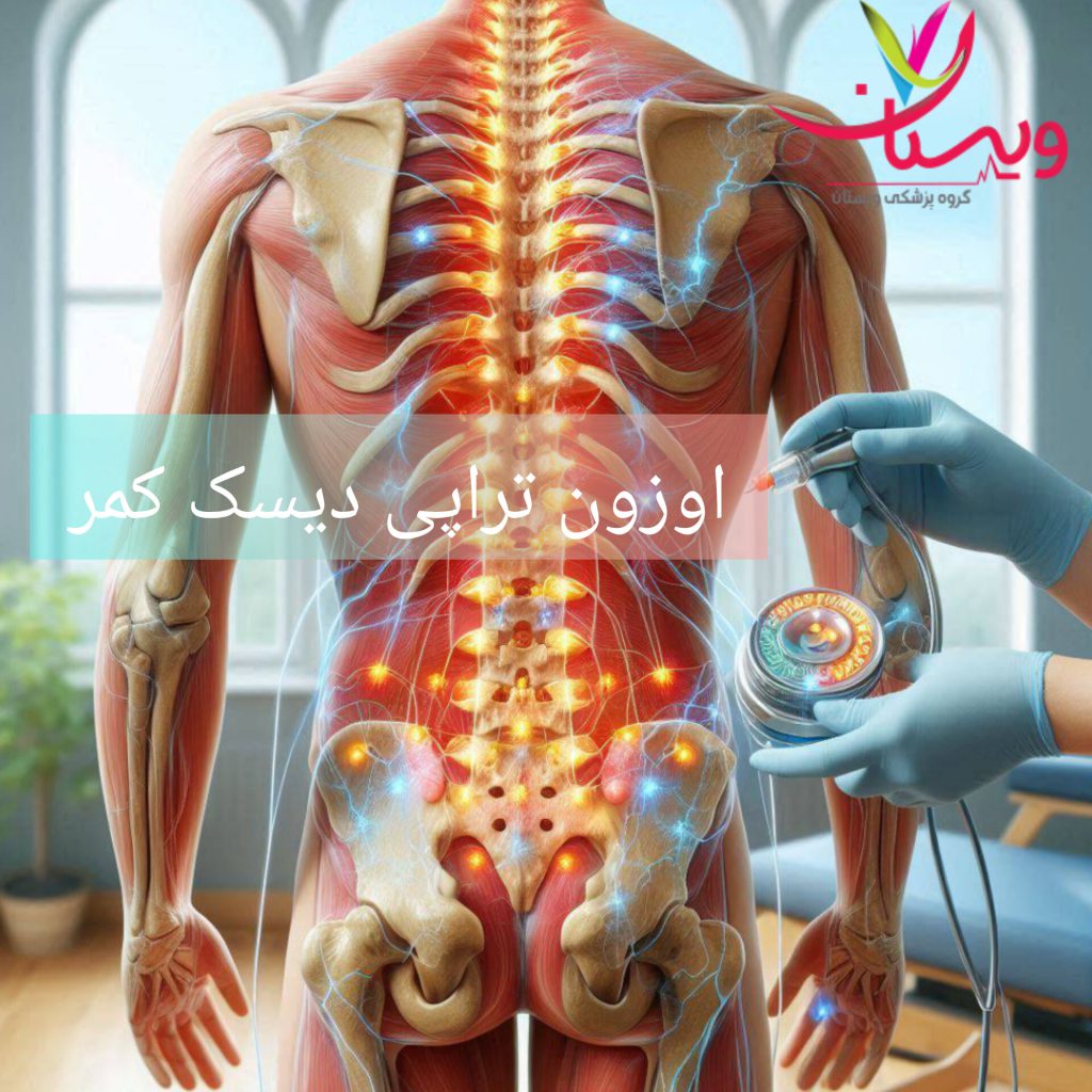 اوزون تراپی برای درمان دیسک کمر اوزون تراپی دیسک کمر برای بیمار