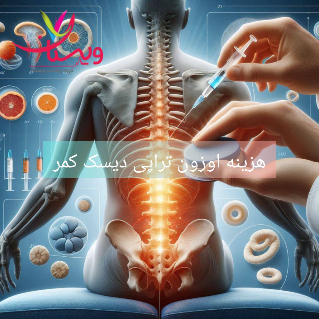 اوزون تراپی کمر و هزینه آن پزشک متخصص برای بیمار اوزون تراپی دیسک کمر انجام می دهد