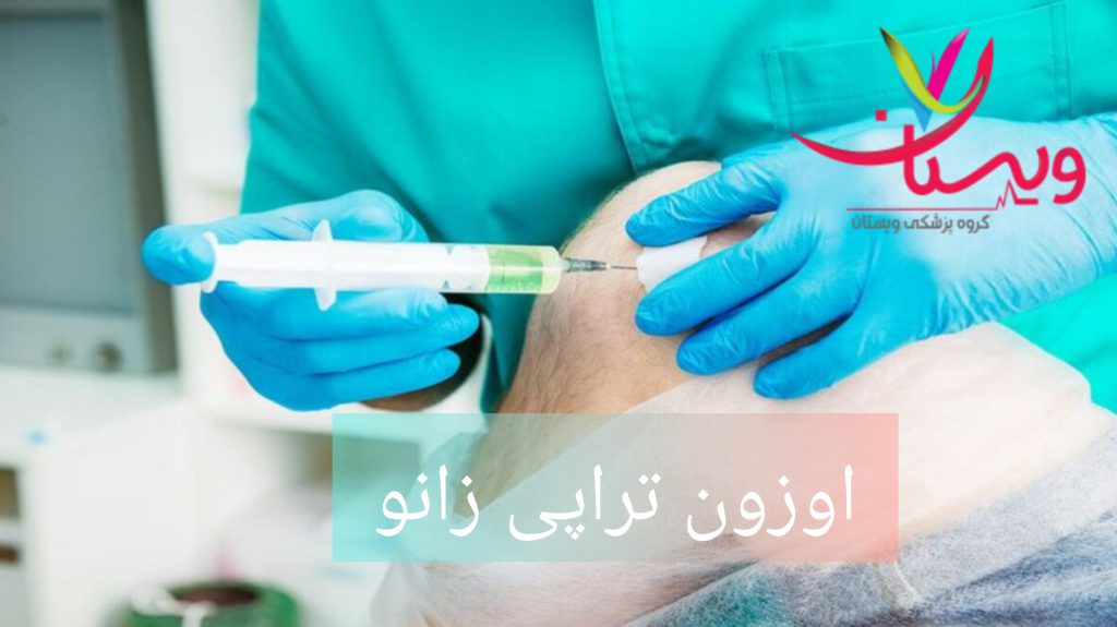 اوزون تراپی برای زانو پزشک برای بیمار اوزون تراپی زانو انجام میدهد