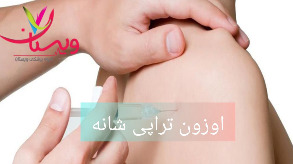اوزون تراپی برای شانه پزشک برای بیمار اوزون تراپی شانه انجام میدهد