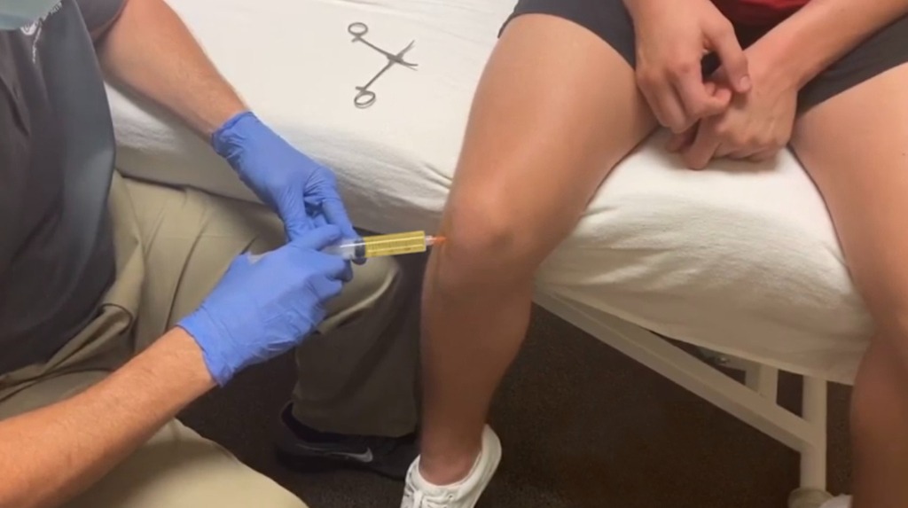 تزریق پی آر پی به زانو تزریق پی آر پی به زانو