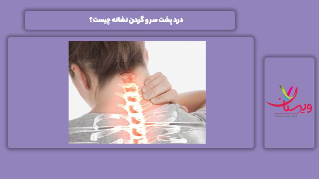علائم درد پشت سر و گردن درد پشت سر و گردن نشانه چیست؟