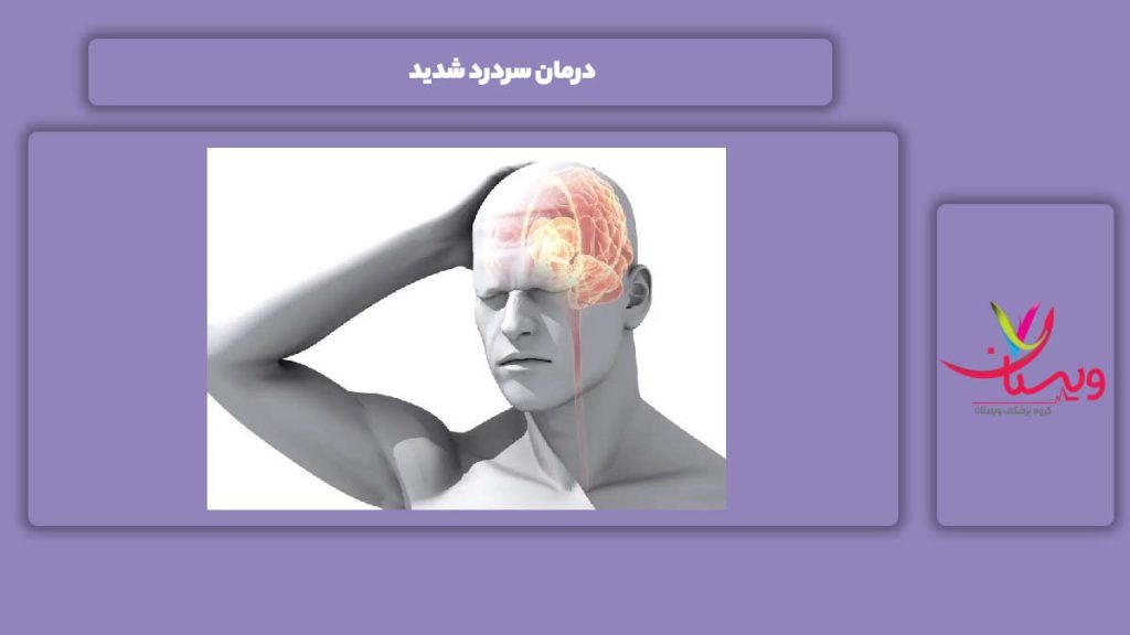 خوب کردن سردرد سردرد شدید