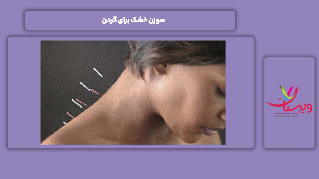 خوب شدن گردن با سوزن خشک سوزن خشک برای گردن