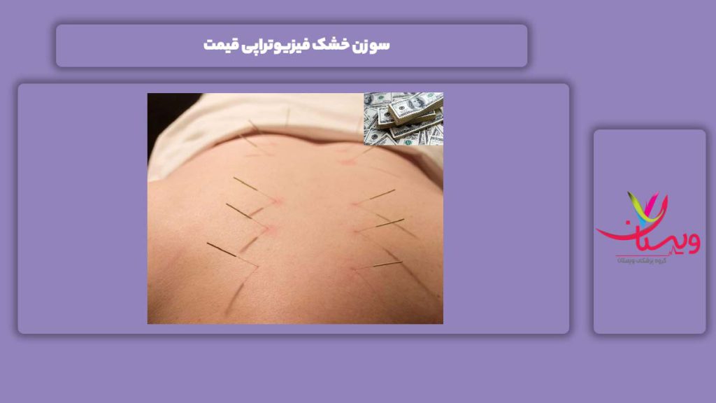 عوامل موثر بر قیمت سوزن خشک فیزیوتراپی قیمت