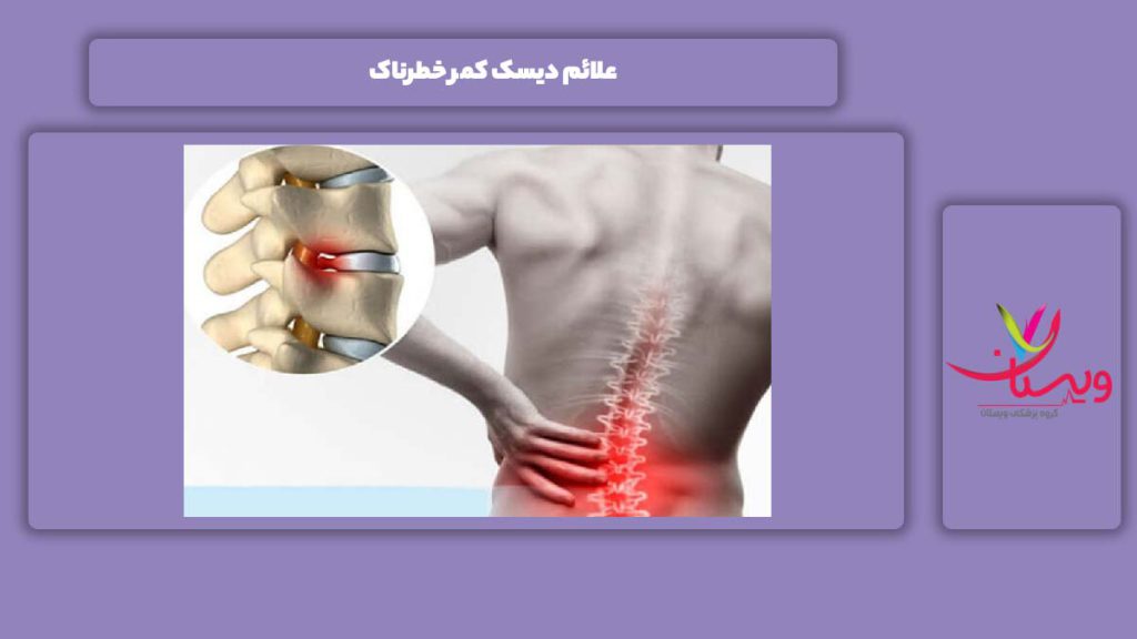 علامت دیسک کمر خطرناک علائم دیسک کمر خطرناک