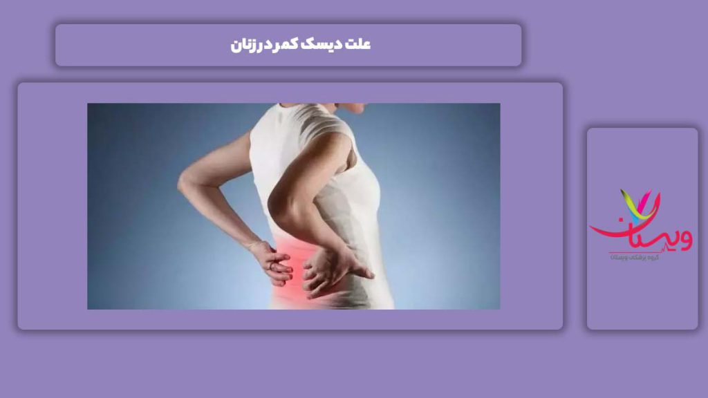 دلیل این مریضی در زنها علت دیسک کمر در زنان