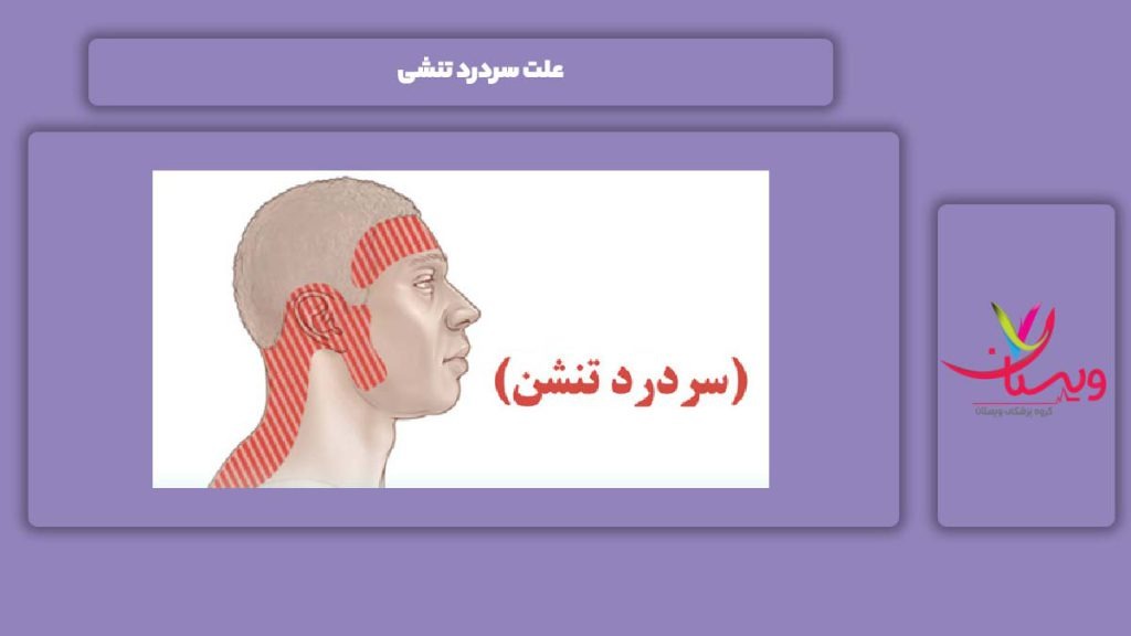 دلیل سردرد تنشی علت سردرد تنشی