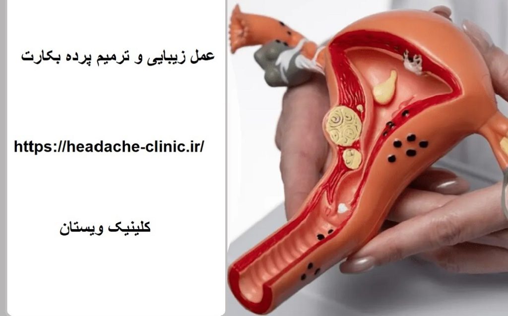 آناتومی پرده بکارت هایمن