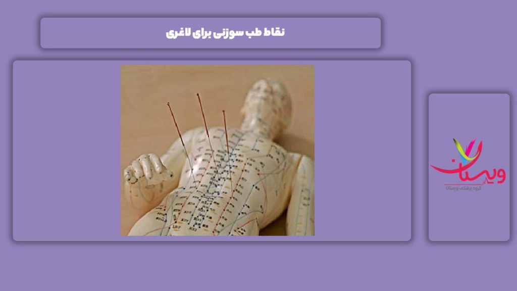 مناطق طب سوزنی برای لاغری نقاط طب سوزنی برای لاغری