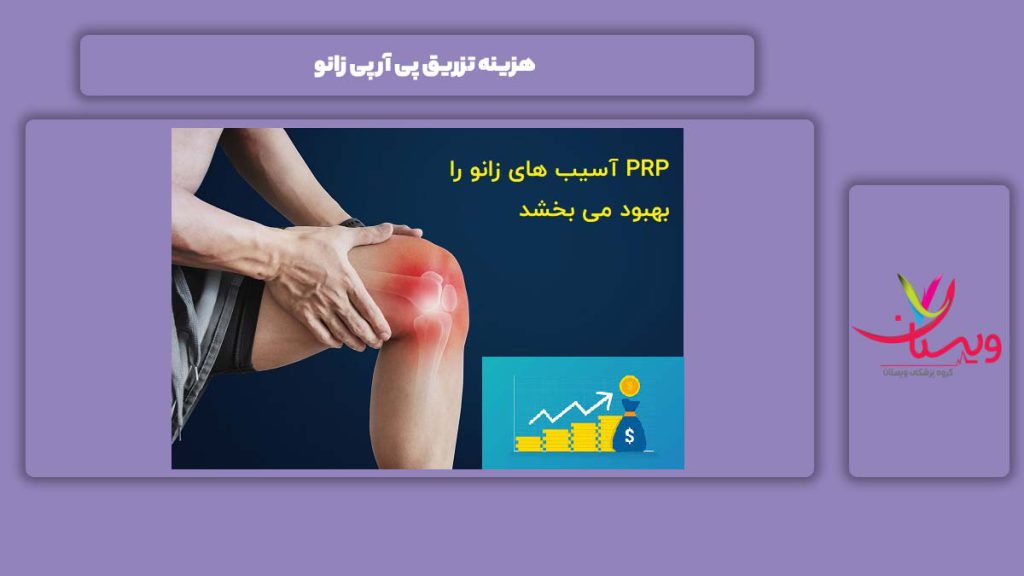تعرفه تزریق پی آر پی برای زانو هزینه تزریق PRP زانو