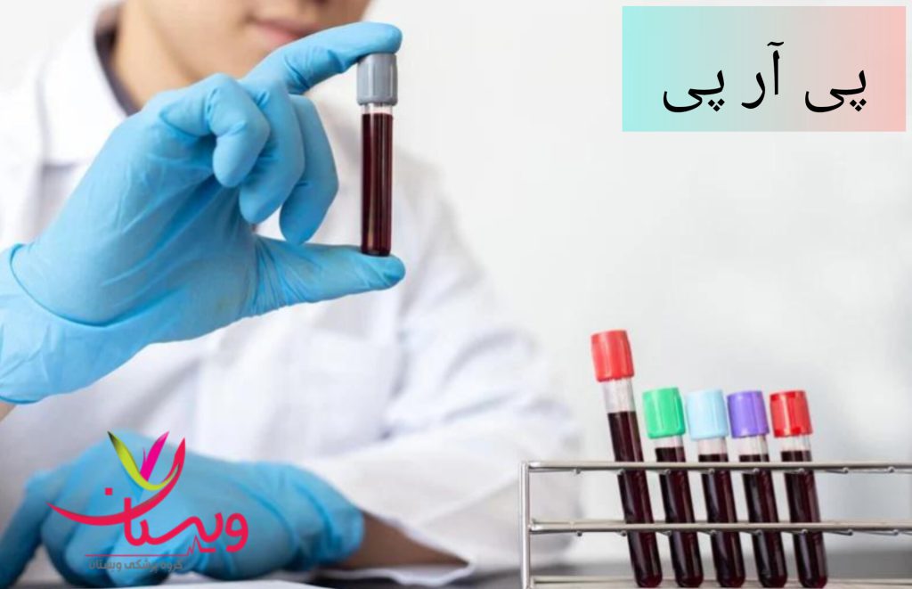 پلاسمای غنی از پلاکت پزشک در حال آماده سازی پلاسمای غنی از پلاکت