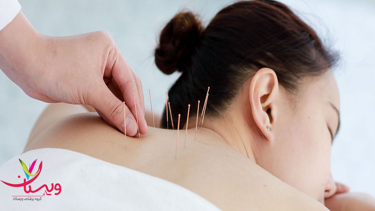 خطرات طب سوزنی عوارض طب سوزنی