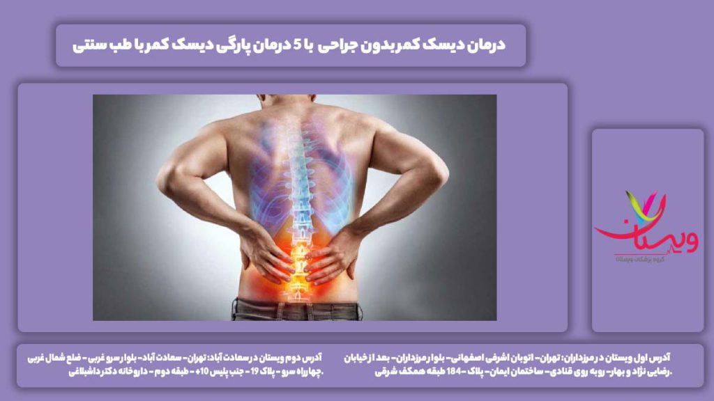 درمان دیسک کمر بدون جراحی
