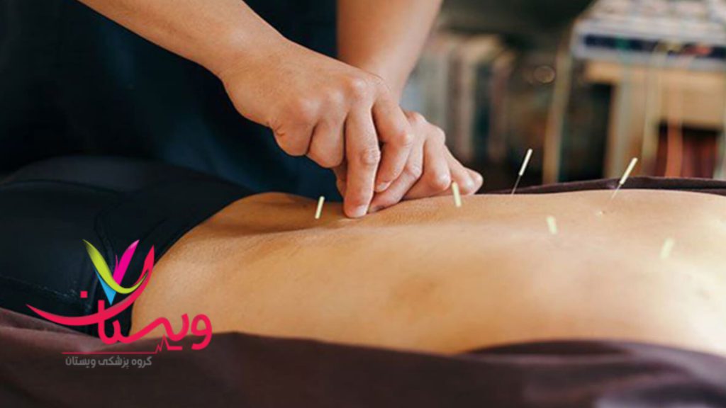 انجام امبدینگ توسط متخصص متخصص در حال انجام امبدینگ لاغری